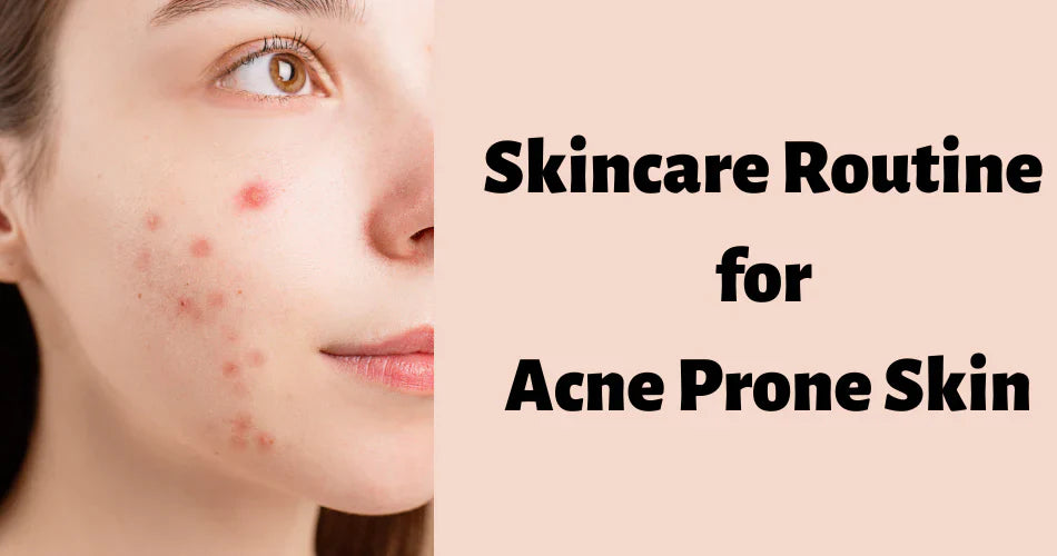 The Best Skincare Routine for Acne-Prone Skin