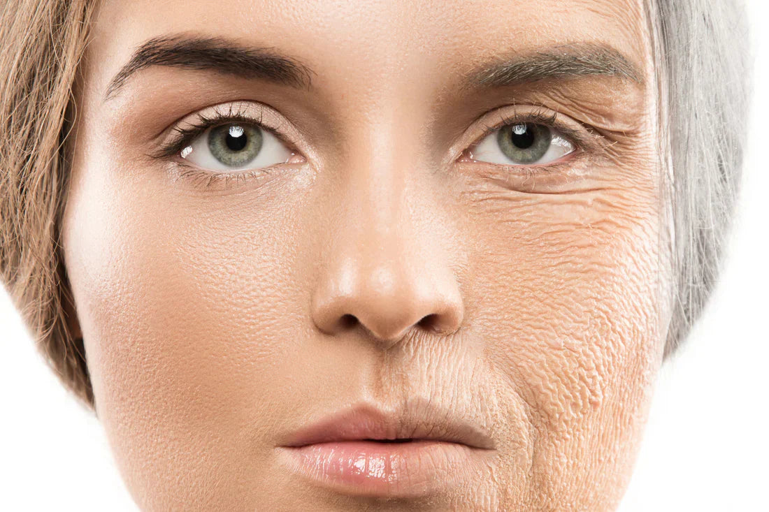 How to Prevent and Treat Fine Lines and Wrinkles