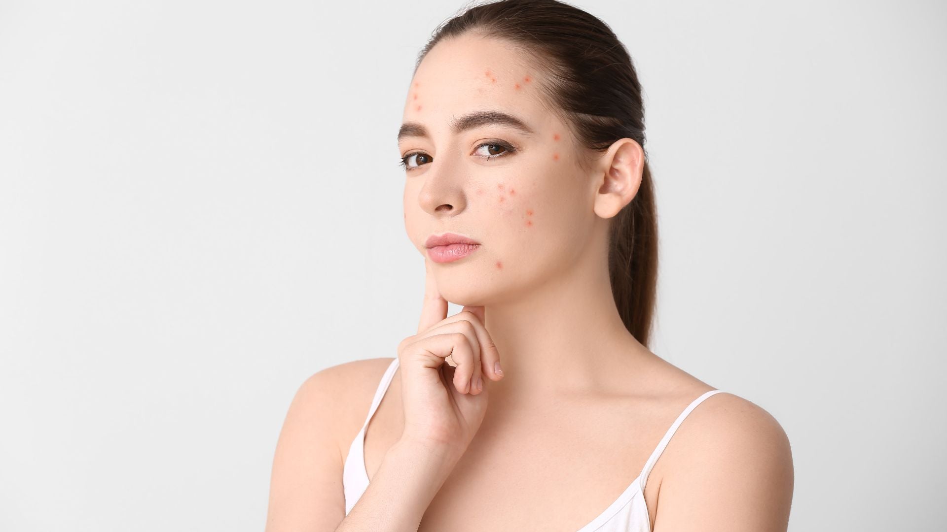 How to Manage Skin Breakouts in the UAE's Hot Climate 